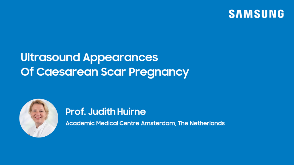 Ultrasound Appearances Of Caesarean Scar Pregnancy