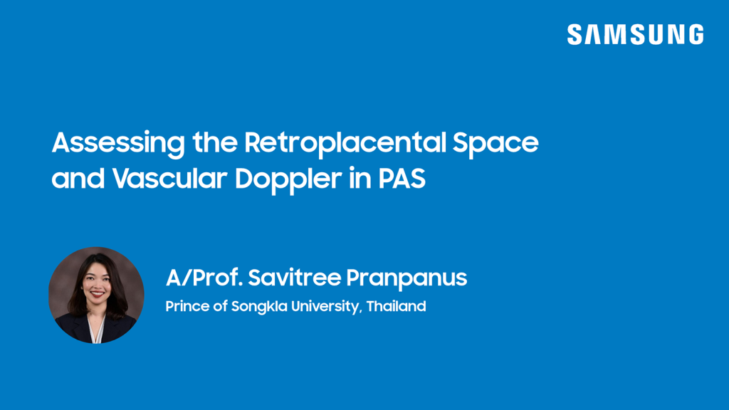 Assessing the Retroplacental Space and Vascular Doppler in PAS
